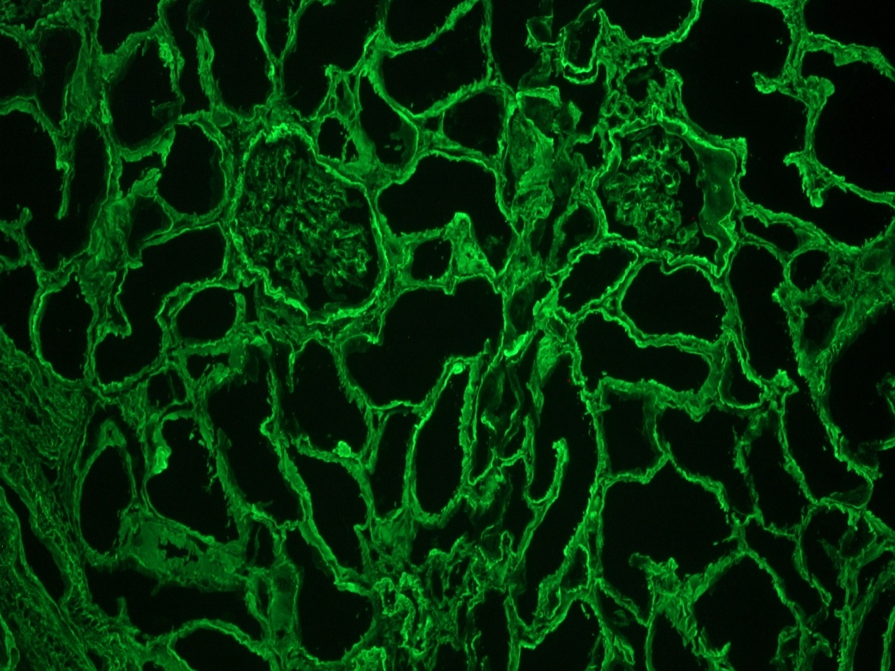 Figure 1. Strong collagen type IV specific staining of MUB0337P Clone 1043) in the basement membrane surrounding epithelial ducts and glomeruli in a frozen section of human kidney up to a 1:200 dilution. Also staining in the connective tissue and muscular layer of blood vessels. No staining of epithelial cells.